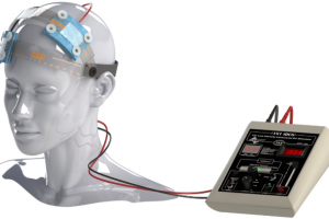 مرکز پزشکی، درمانی و آموزشی "لقمان حکیم" به دستگاه "تحریک الکتریکی فراجمجمه‌ای مغز" مجهز شد