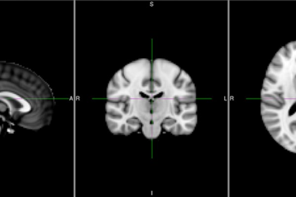 پردازش تصاویر fMRI - قسمت هفدهم