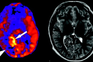 خدمتی جدید از آزمایشگاه ملی نقشه برداری مغز:‌ آنالیز تصاویر ASL در بخش پردازش تصویر