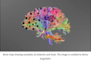 Learning difficulties due to poor connectivity, not specific brain regions