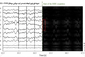 راه اندازی خدمت پیش پردازش داده EEG ثبت شده با fMRI در آزمایشگاه نقشه‌برداری مغز