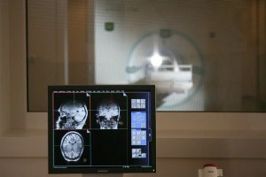 Revolutionary MRI Imaging Technique Reveals Brain Glucose Metabolism Without Radiation Exposure