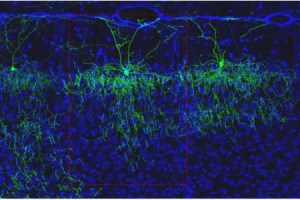 زیرمجموعه‌های جدیدی از سلول‌ها در مغز موش طبقه بندی شده‌اند