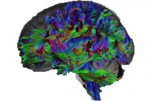 مغز افرادی که اطلاعات عمومی بالایی دارند به چه شکلی است؟