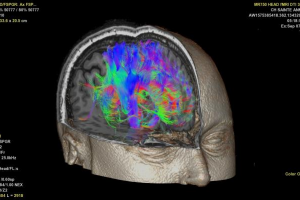 یادگیری ماشین بینشهای جدیدی را به سوی مغز انسان از طریق اسکن fMRI آشکار می‌سازد